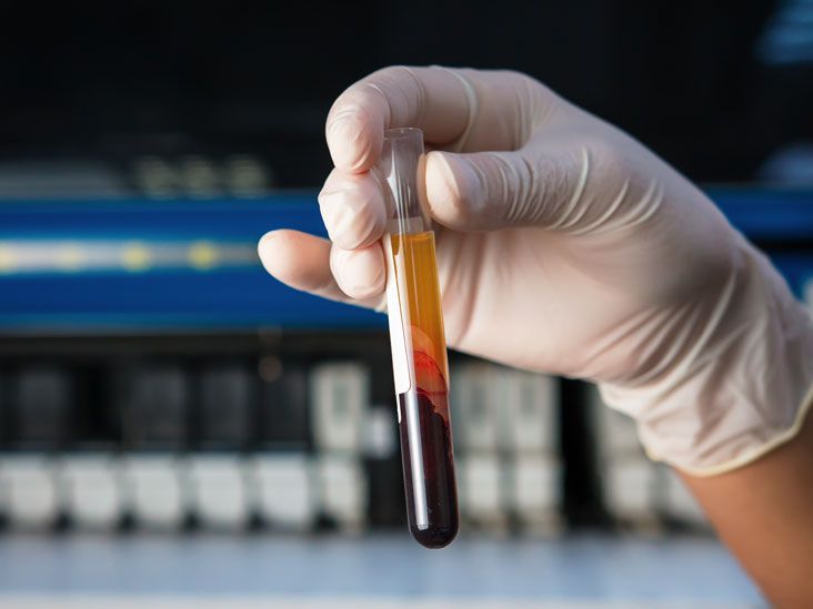Prothrombin Time Test: Purpose, Procedure, and Results